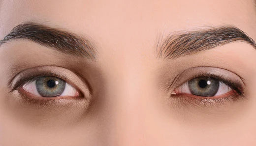 How to Get Rid of Dark Circles?